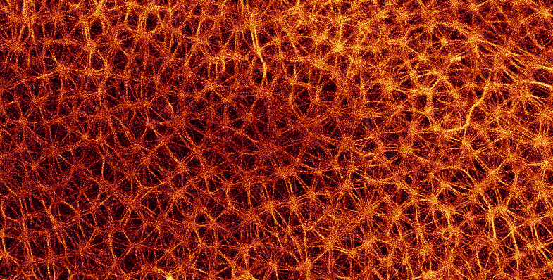 enlarge the image: Pattern formation through entropically driven self-assembly of actin