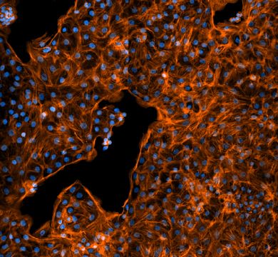 Fötale Lungenzellen von Ratten, wie sie in den Experimenten verwendet werden. Die Zellkerne sind blau und die Aktinfilamente des Zytoskeletts orange dargestellt. 