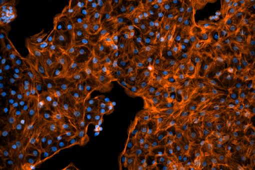 Fötale Lungenzellen von Ratten, wie sie in den Experimenten verwendet werden. Die Zellkerne sind blau und die Aktinfilamente des Zytoskeletts orange dargestellt. 