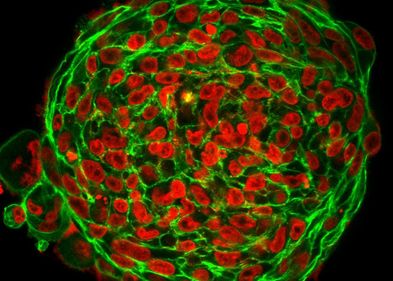 Actin and DNA staining reveal the structure of 3D tumour clusters. Cell shapes in cancer tumours indicate whether cells are motile. Aktin- und DNA-Färbung verraten die Struktur von 3D-Tumorclustern. Zellformen in Krebstumoren zeigen an, ob die Zellen beweglich sind.